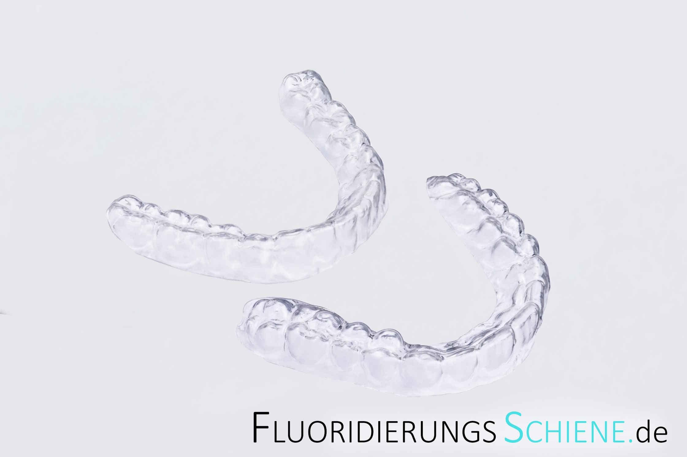 Individuelle Fluoridierungsschienen für Ober- und Unterkiefer