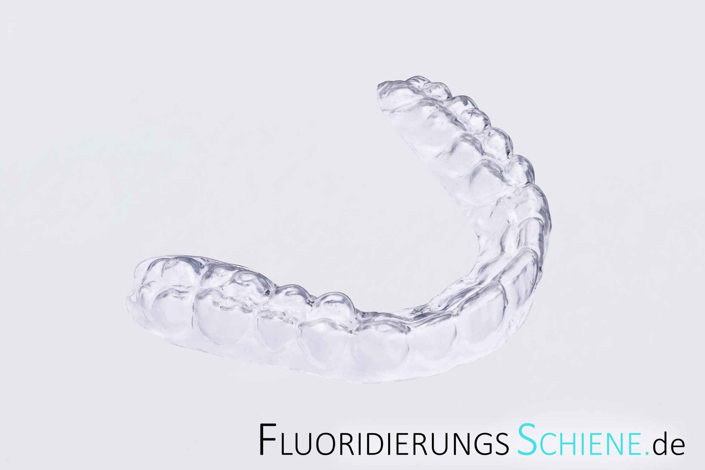 Individuelle Fluoridierungsschiene für Oberkiefer only